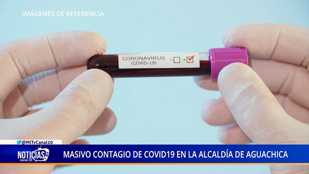 MASIVO CONTAGIO DE COVID19 EN LA ALCALDÍA DE AGUACHICA