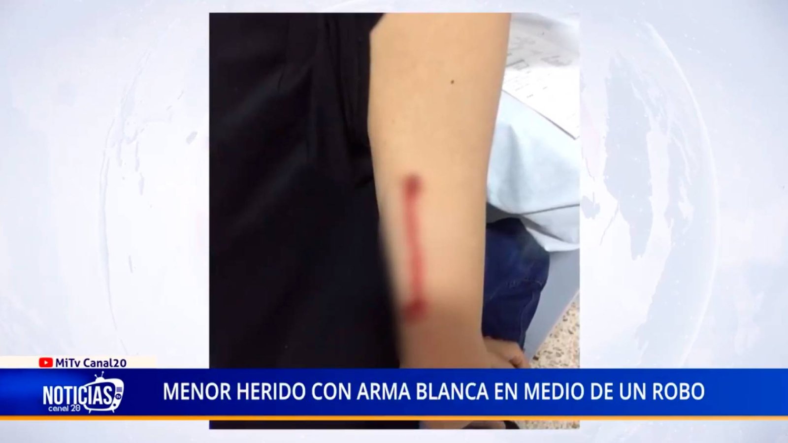 MENOR HERIDO CON ARMA BLANCA EN MEDIO DE UN ROBO