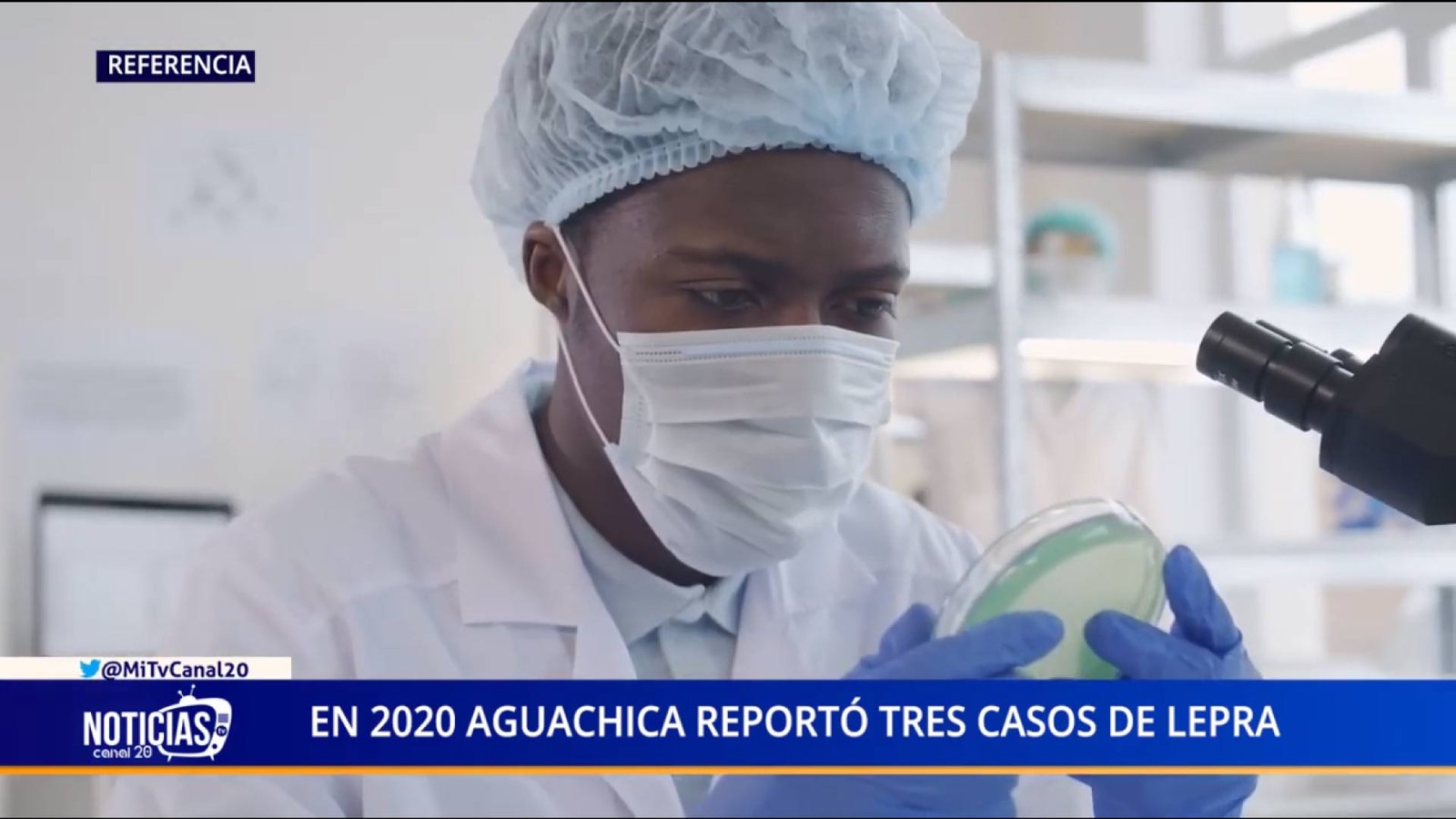 EN 2020 AGUACHICA REPORTÓ TRES CASOS DE LEPRA