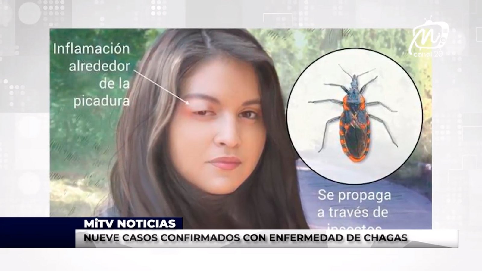 NUEVE CASOS CONFIRMADOS CON ENFERMEDAD DE CHAGAS