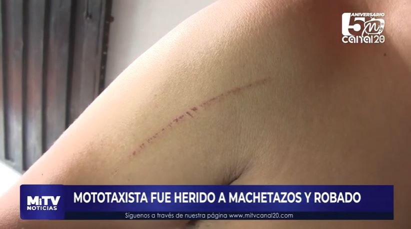 MOTOTAXISTA FUE HERIDO A MACHETAZOS Y ROBADO