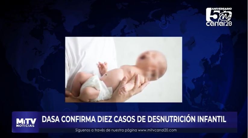 DASA CONFIRMA DIEZ CASOS DE DESNUTRICIÓN INFANTIL