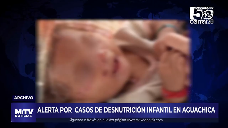 ALERTA POR CASOS DE DESNUTRICIÓN INFANTIL EN AGUACHICA